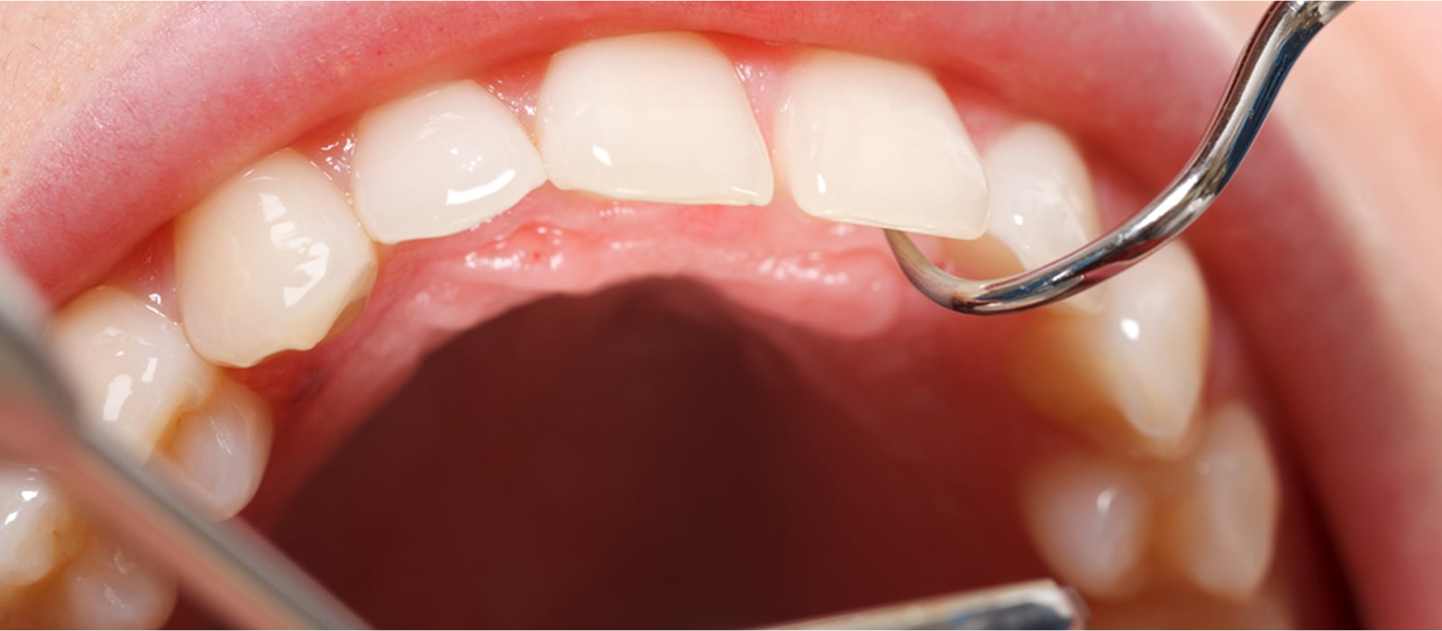 治療計画の説明